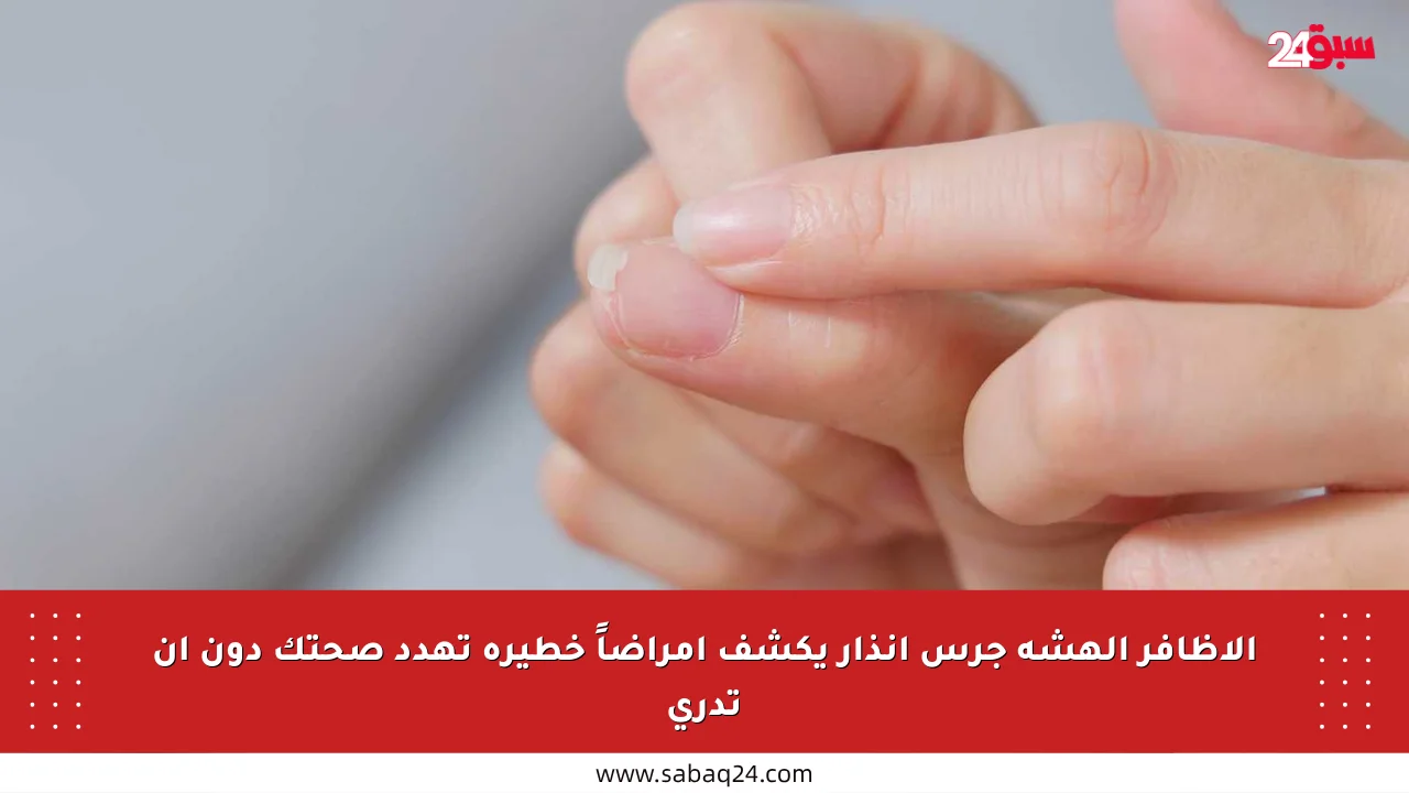 الأظافر الهشة جرس إنذار يكشف أمراضاً خطيرة تهدد صحتك دون أن تدري